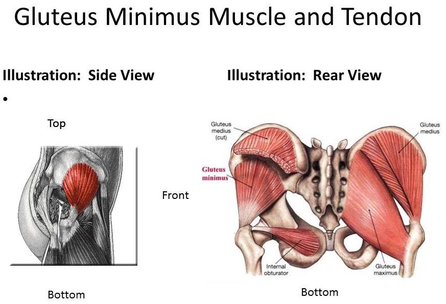 Gluteus Medius Pain - What It Feels Like And How To Fix It